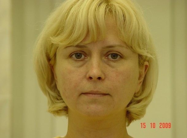 До