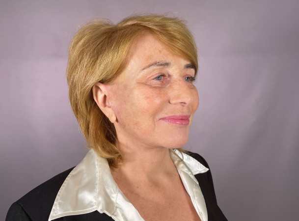 Тотальная подтяжка лица - После (threeQuarterView)