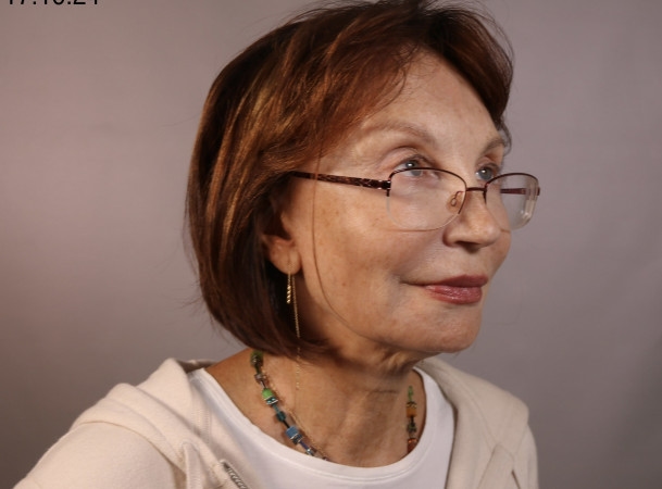 Тотальная подтяжка лица - До (Анфас)