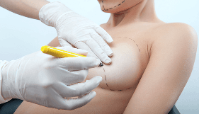 Маммопластика