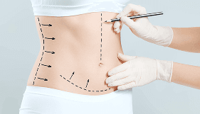 Пластика тела