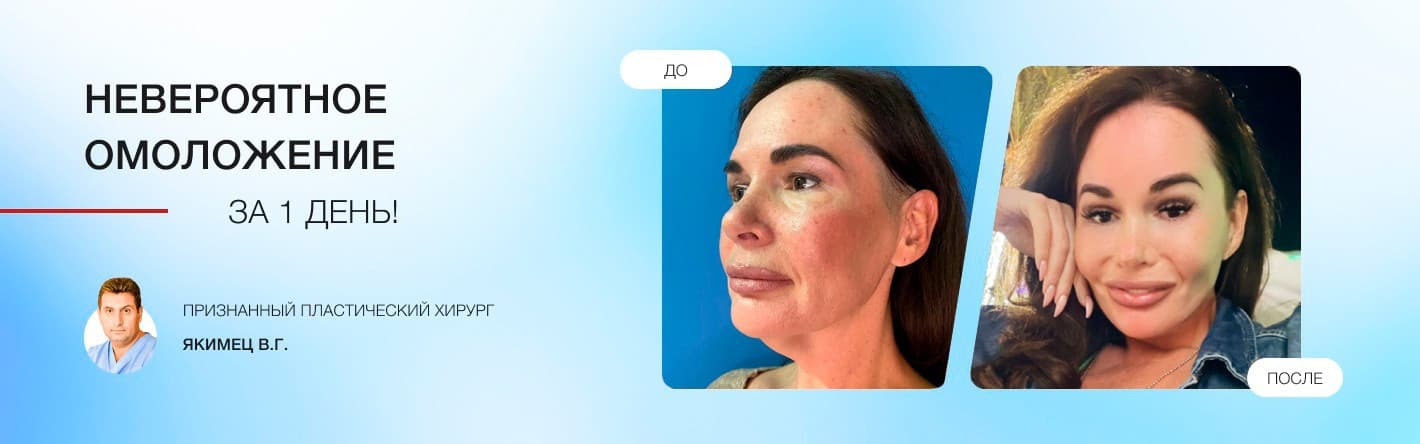 Невероятное омоложение