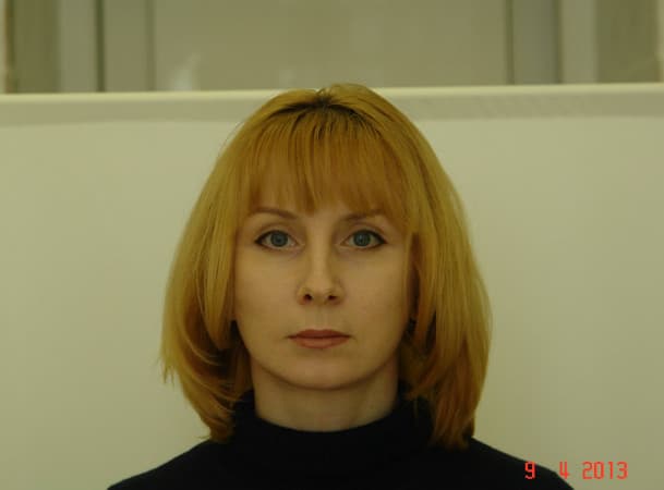 Эндоскопический лифтинг лба, Блефаропластика нижних век, СМАС-лифтинг, Платизмопластика - после