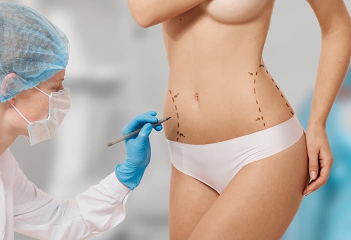 Пластика тела