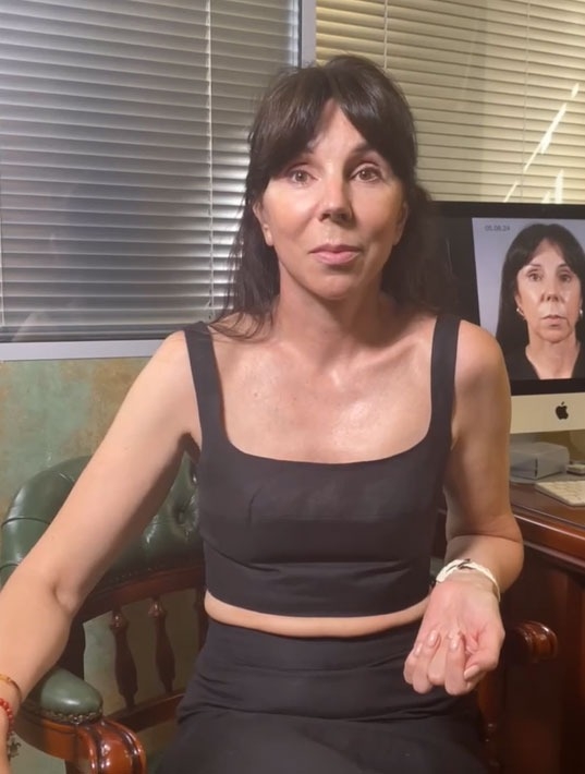 Лифтинг лба и овала лица - Видео превью