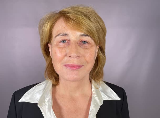 Тотальная подтяжка лица - После (frontView)