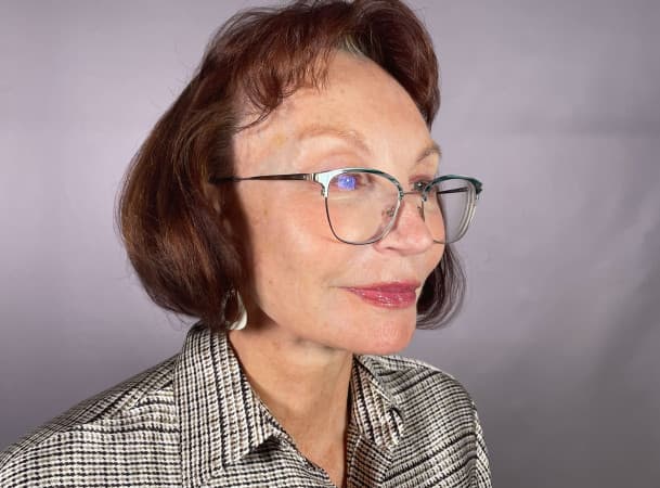 Тотальная подтяжка лица - после