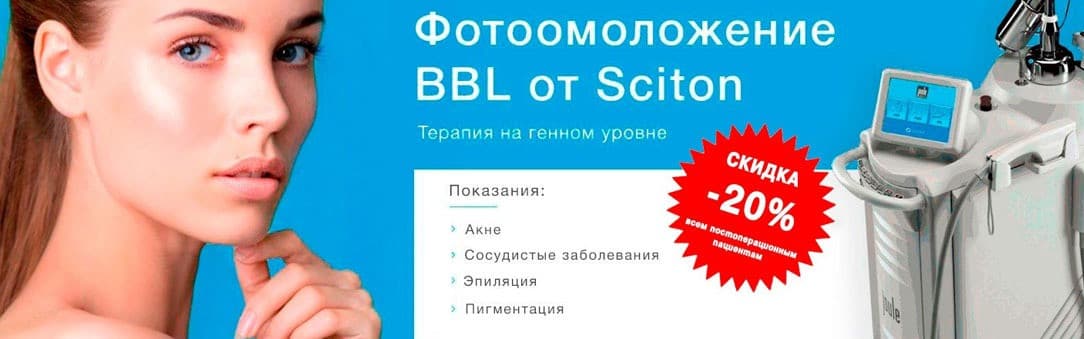 Фотоомоложение BroadBandLight -20%!
