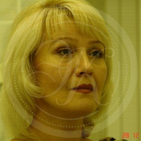 Тотальный лифтинг лица: эндоскопия лба, средней зоны лица, блефаропластика нижних век, СМАС-лифтинг лица, платизмопластика, Три четверти, фото После