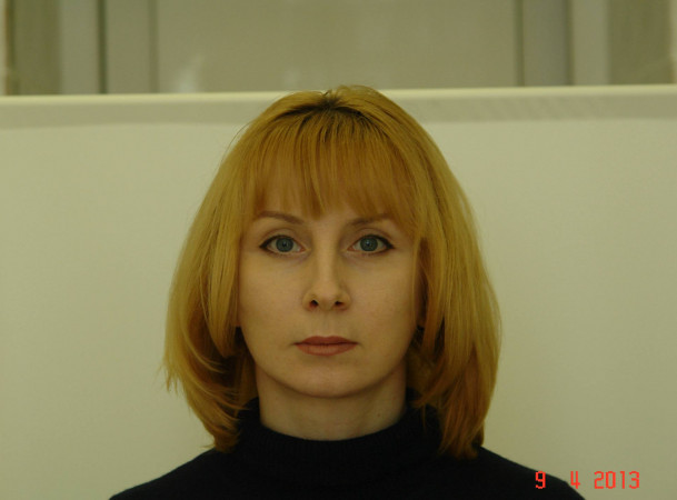 Эндоскопический лифтинг лба, Блефаропластика нижних век, СМАС-лифтинг, Платизмопластика - после